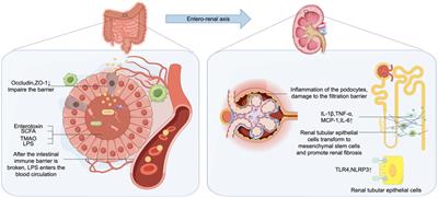 Research progress of gut microbiome and diabetic nephropathy